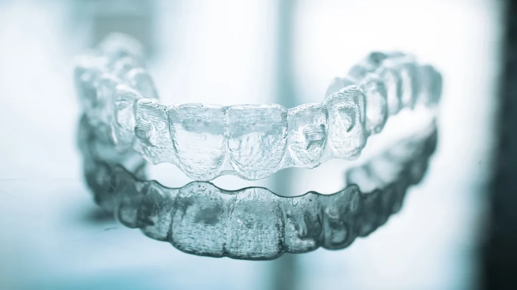 5 Alasan Utama Mengapa Invisalign Masih Populer untuk Pelurusan Gigi