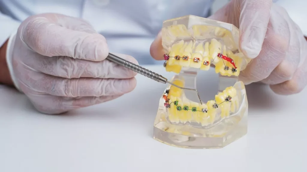 5 Tanda Anda Perlu Menemui Dokter Gigi Orthodontis