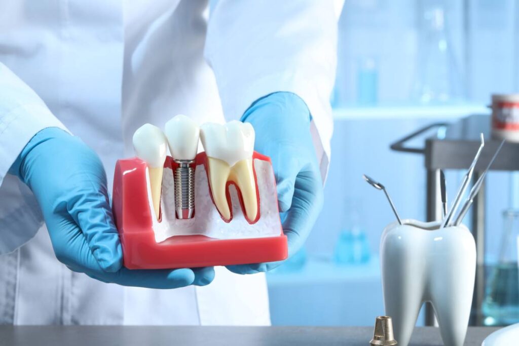 Apa yang Dimaksud dengan Prostodontist?