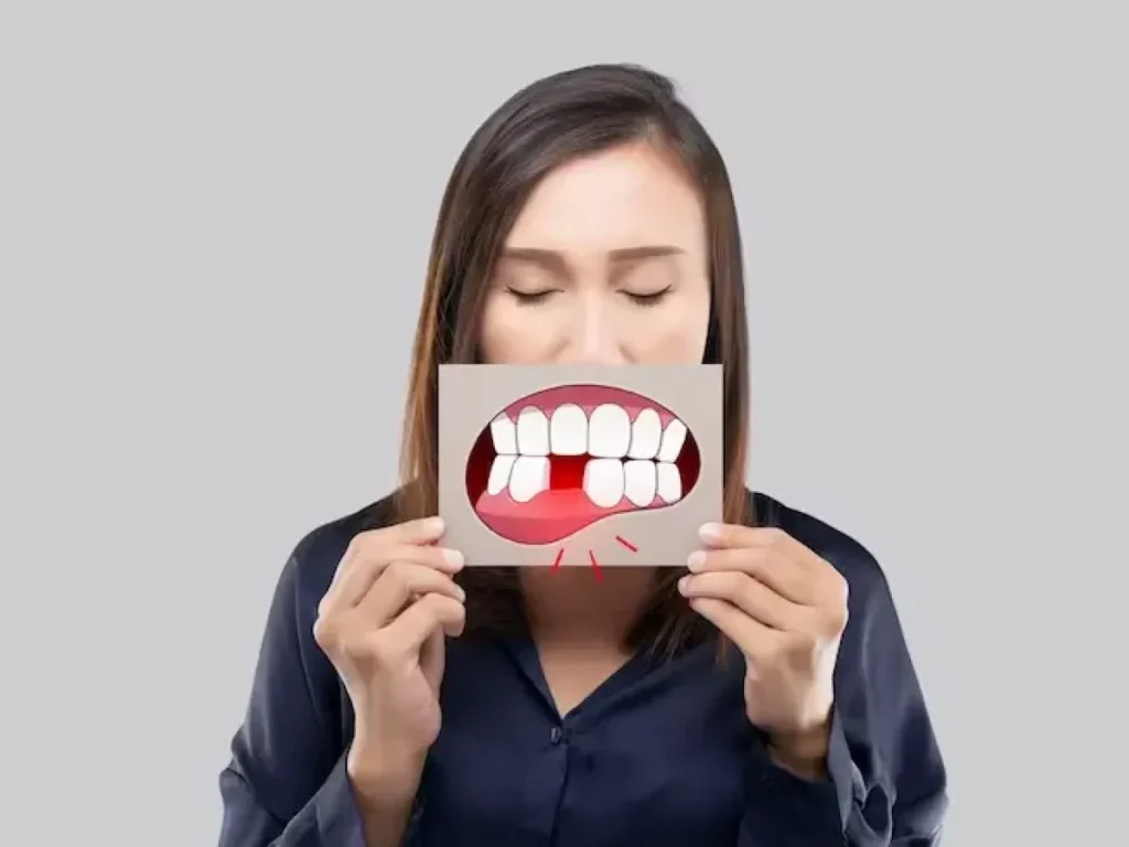Kehilangan Gigi?! Apa Saja Pilihan Saya?
